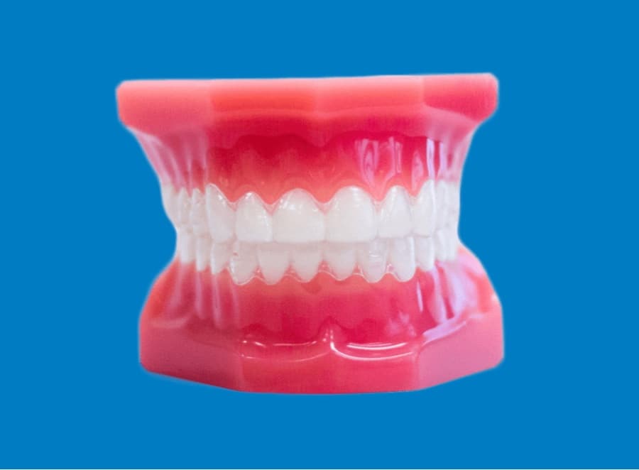 invisalign aligners on plastic model