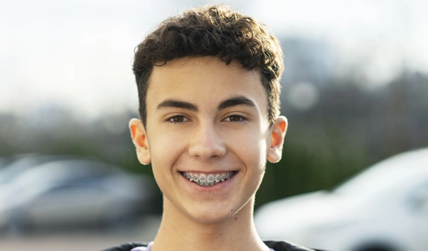 img-Braces-spring-office Spring Orthodontic Office